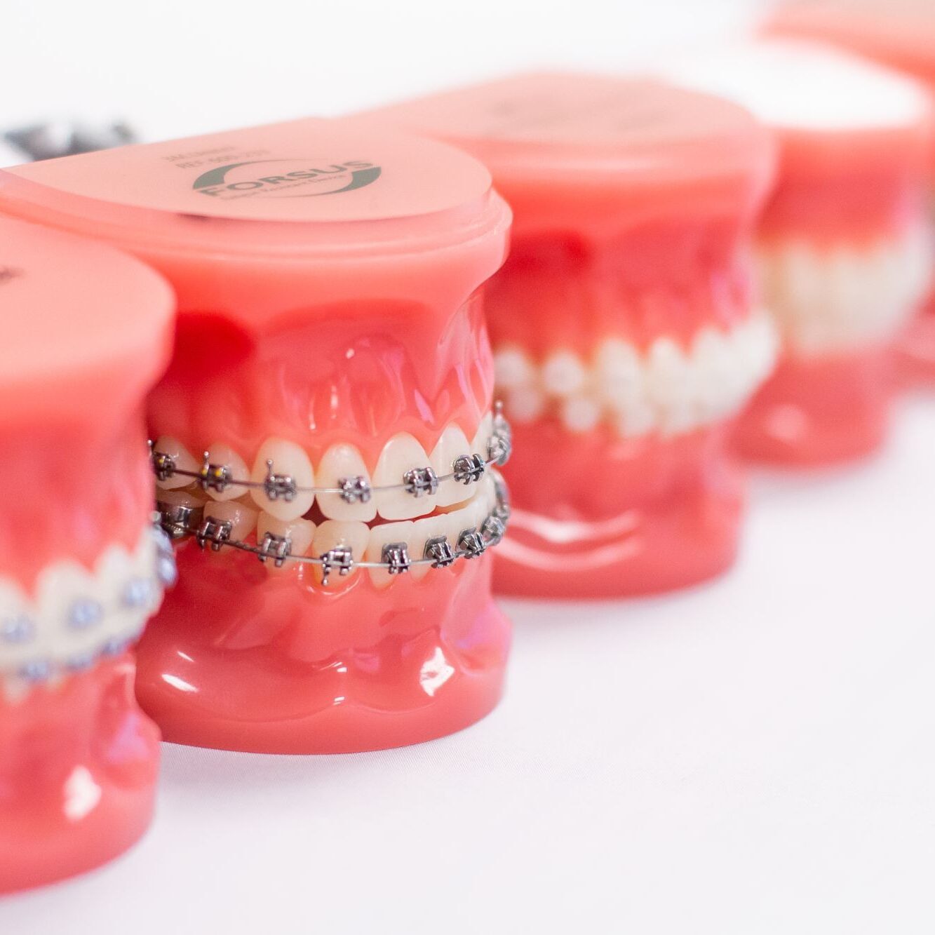 Model of traditional metal braces orthodontic appliance